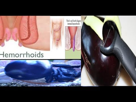 لايف ستايلشاهد: قشور حبة باذنجان تخلصك من البواسير والشرخ الشرجي بطريقة طبيعية وآمنة62484/0