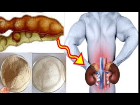 لايف ستايلشاهد: وصفة جديدة حيّرت الأطباء لعلاج الفشل الكلوي وأمراض الكلى63182/0