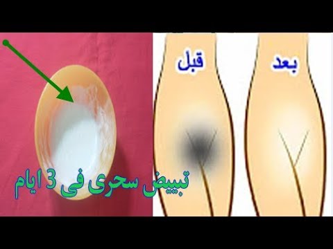 لايف ستايلحل سحري لتبييض وتفتيح المناطق الحسّاسة63801/0