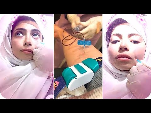 لايف ستايلشاهد: دارين البايض تحقن بلازما الدم في الوجه64539/0