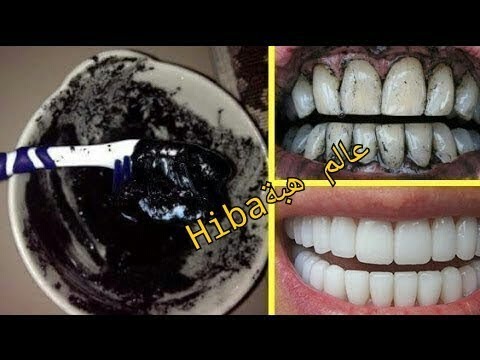 لايف ستايلالوصفة المعجزة لتبييض الأسنان خلال دقيقة واحدة64827/0