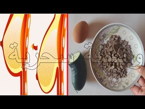 لايف ستايلبالفيديو أقوى علاج لترهل الثدي وشد الصدر64933/0