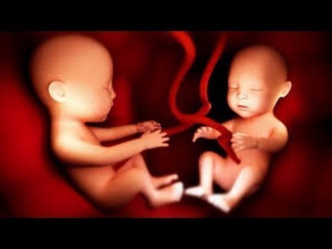 لايف ستايلبالفيديو: طرق طبيعية مفيدة للمرأة لإنجاب التوائم64965/0