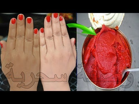 لايف ستايلشاهد: وصفة جديدة لتبييض اليدين خلال دقائق 65744/0