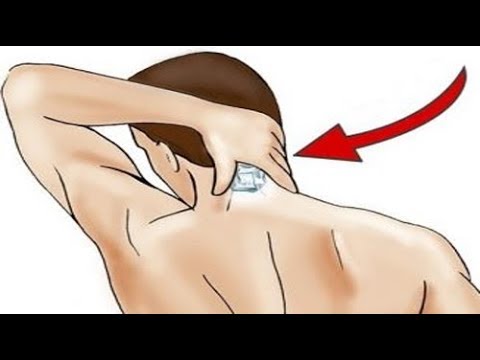 لايف ستايلشاهد: ماذا يحدث عندما تقوم بتثبيت قطعة من الثلج في هذه النقطة من الرأس66938/0