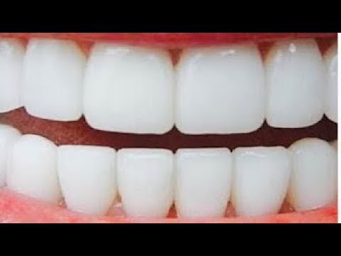 لايف ستايلبالفيديو: تبييض الأسنان في دقيقتين وإزالة الاصفرار بمكونين فقط67530/0