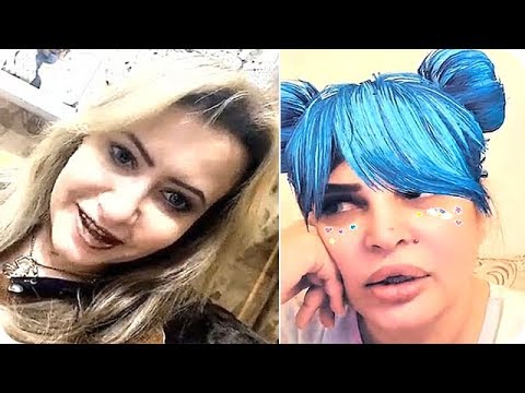 لايف ستايلمي العيدان تلومها على إجراء عملية شفط دهون67640/0