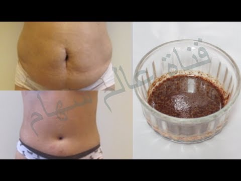 لايف ستايلبالفيديو: وصفة سحرية للتخلص من دهون البطن بدون رياضة68135/0