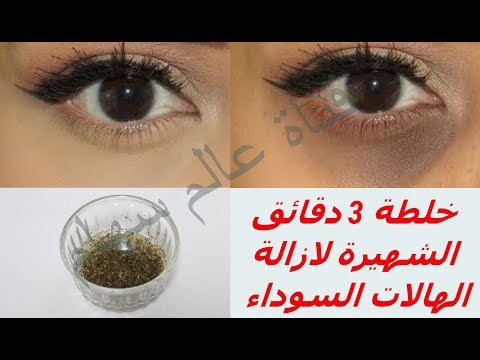 لايف ستايلتعرفي على خلطة 3 دقائق الشهيرة لإزالة الهالات السوداء68139/0