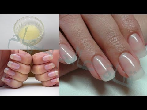لايف ستايلشاهد: أسرع خلطة لتطويل الأظافروتقويتها على الإطلاق68143/0