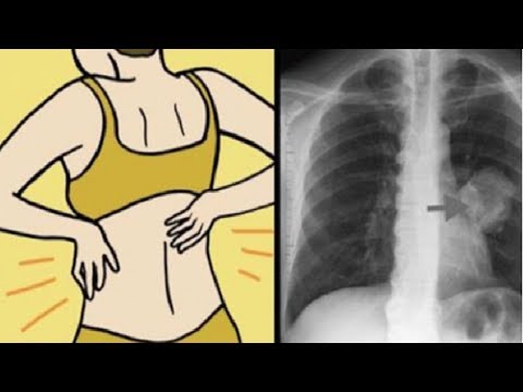 لايف ستايلشاهد: متى تذهب فورًا إلى الطبيب 68207/0