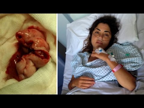 لايف ستايلشاهد: سيدة اكتشفت بالصدفة إصابتها بالسرطان68324/0