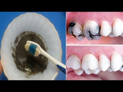 لايف ستايلوصفة سهلة للحصول على أسنان بيضاء68667/0