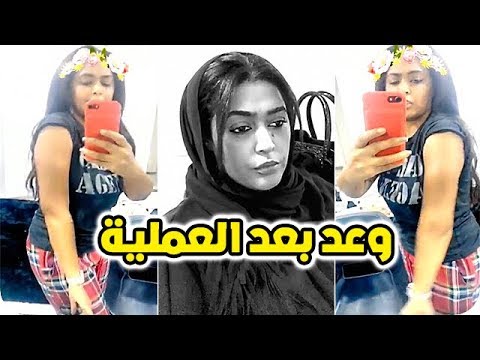 لايف ستايلشاهد: الفنانة وعد تجري عملية في يدها68972/0