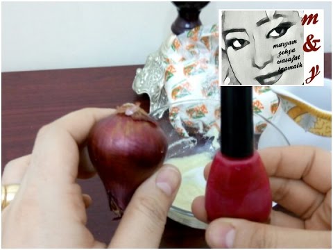 لايف ستايلالتخلّص من مشكلة النمش والكلف والبقع خلال أيام69971/0