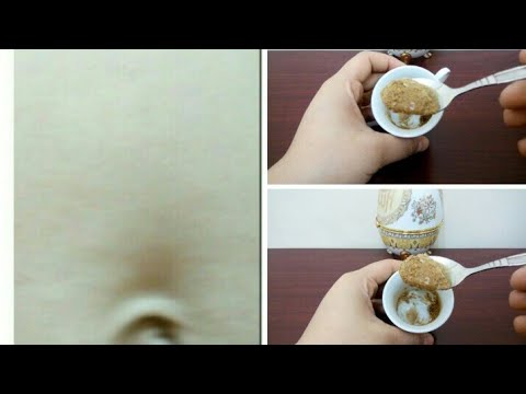 لايف ستايلبالفيديو: تخلص الكرش ودهون البطن بملعقة على الريق مع خبيرة التجميل مريم يحيى70358/0