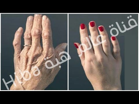 لايف ستايلوصفة سحرية ونهائية للتخلص من التجاعيد71014/0