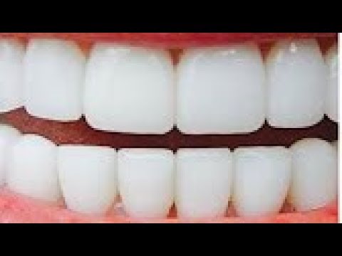 لايف ستايلوصفة لتبييض الأسنان في دقيقتين وإزالة الإصفرار71368/0