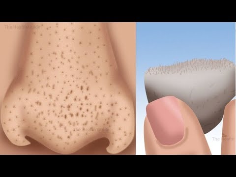 لايف ستايلشاهد: 5 طرق لإزالة النقاط السوداء على الأنف في 3 دقائق71826/0