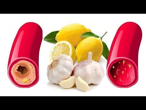 لايف ستايلبالفيديو: أطعمة تقلل من خطر الإصابة بالنوبات القلبية71849/0