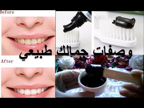 لايف ستايلطريقة إعداد المعجون الأسود لتبييض الأسنان72771/0