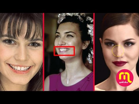لايف ستايلشاهد| عيوب لم تراها في أجساد النجمات التركيات لم تؤثر على جمالهن72897/0