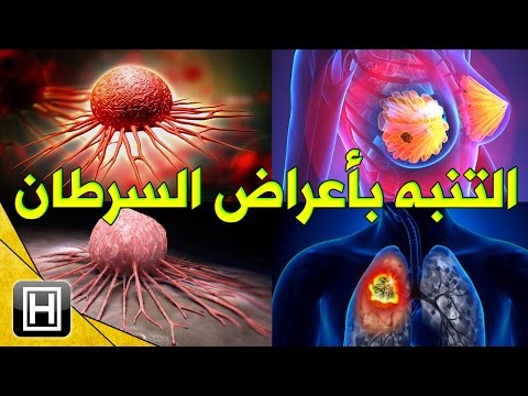 لايف ستايلتعرف على أعراض السرطان العامة للتصدي لها73203/0