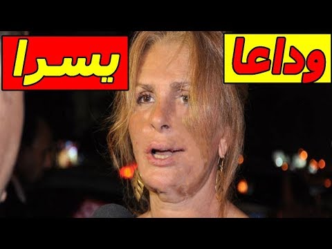 لايف ستايلبالفيديو : يسرا تؤكد أن إصابتها بالربو مجرد إشاعة73502/0