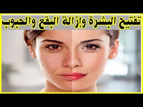 لايف ستايلوصفة لتفتيح بشرة الوجه وإزالة البقع والحبوب73811/0