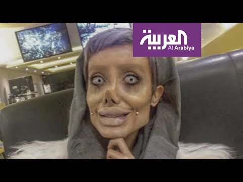 لايف ستايلشاهد: فتاة تُجري 50 عملية تجميل لتُشبه أنجلينا جولي73982/0