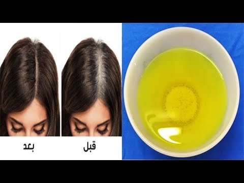 لايف ستايلمركب يخترق فروة الرأس ويعالج شيب الشعر ومن غير صبغة74118/0