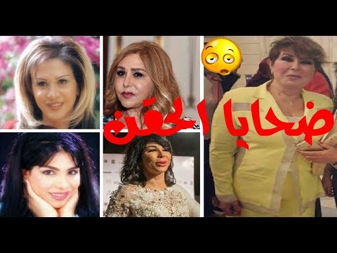 لايف ستايلشاهد: 15 فنانة شهيرة تشوهن بعد عمليات التجميل74228/0