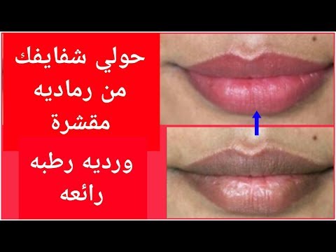 لايف ستايلحولي شفايفك من رماديه مقشرة إلى وردية رطبة74777/0
