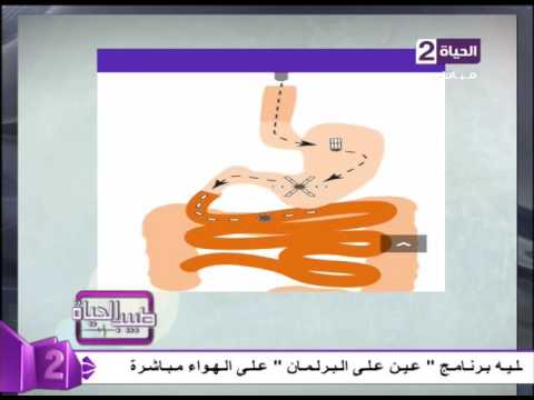 لايف ستايلطفرة جديدة في مجال الطب لمرضى السكر والضغط74954/0