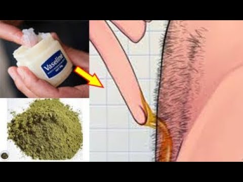 لايف ستايلشاهد: الفازلين وعشبة السعد لازالة شعر العانة76640/0