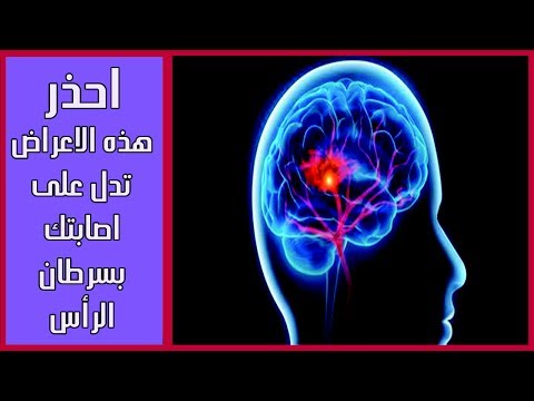 لايف ستايلبالفيديو : أعراض خفية تدل على الإصابة بسرطان المخ76918/0