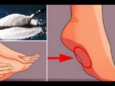 لايف ستايلبالفيديو : 7 أعراض تكشف عن الإصابة بمرض السكري77128/0