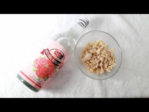 لايف ستايلتخلصي من الحفر والبقع بخلطة لبان الذكر السحرية77145/0