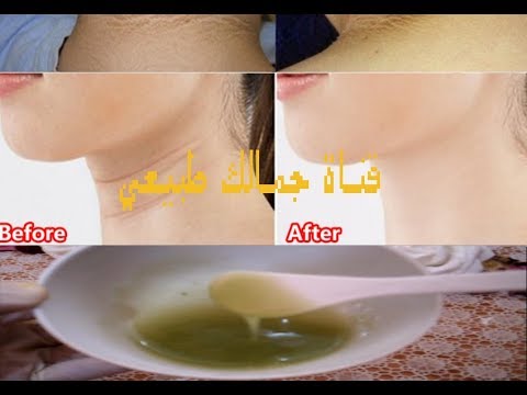 لايف ستايلبالفيديو: الهلام الأخضرالعجيب لتفتيح الرقبة وشدها77406/0