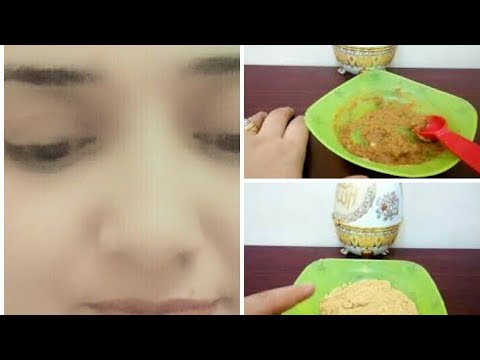 لايف ستايلأنسى حبوب البشرة حب الشباب فى نصف ساعة مع خبيرة التجميل مريم يحيى78003/0