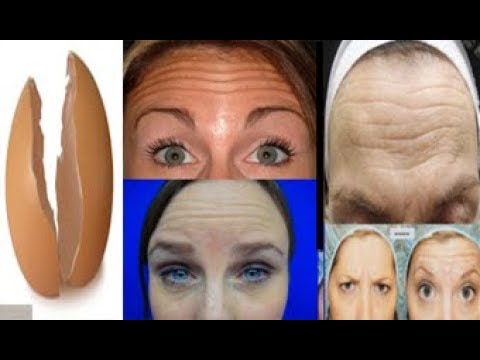 لايف ستايلالوصفة العجيبة لإزالة التجاعيد نهائيًا78207/0