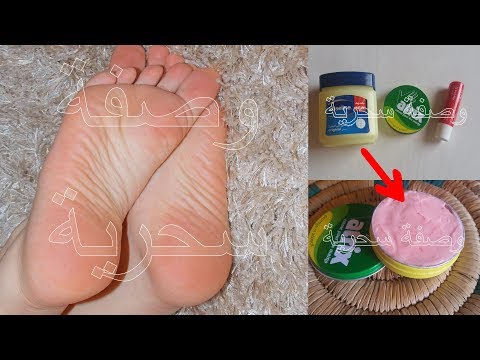 لايف ستايلأقوى مرطب و علاج لتشققات القدم78265/0