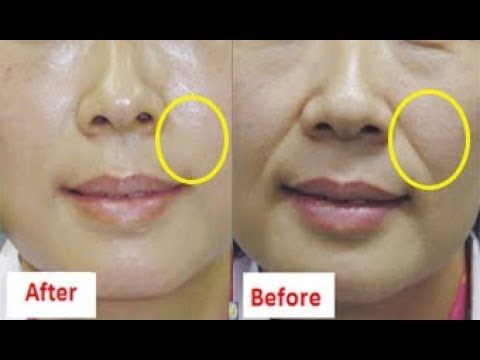 لايف ستايلوصفة أقوى من كريم الكولاجين تجعلك أصغر بـ 10 سنوات78495/0