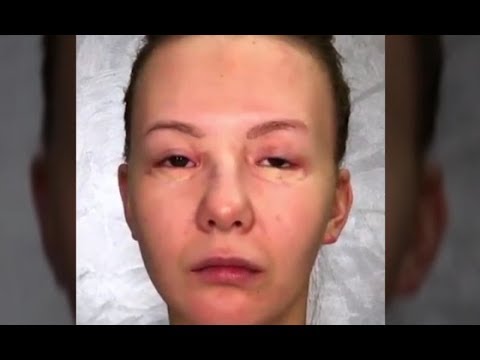 لايف ستايلأقوى مكياجات قبل وبعد لن تصدق بعضهم78673/0