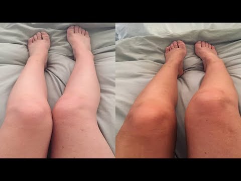 لايف ستايلبالفيديو: طريقة تبييض الجسم خمس درجات79631/0