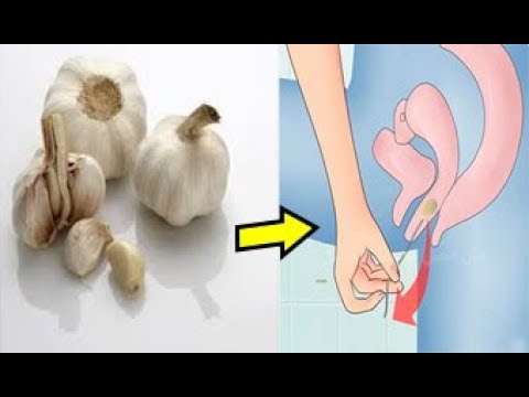 لايف ستايلبالفيديو: حبة ثوم واحدة في المهبل واسعدي زوجك كل ليلة برائحة طيبة79640/0
