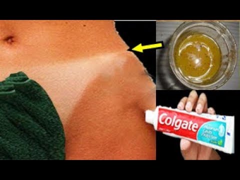 لايف ستايلبالفيديو: وصفة فعالة جدًا لإزالة شعر العانة 79641/0