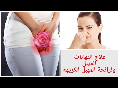 لايف ستايلبالفيديو: علاج الالتهابات المهبلية ورائحة المهبل الكريهة80187/0