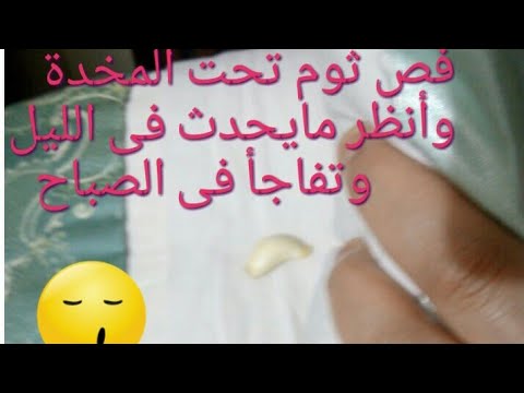لايف ستايلضع الثوم تحت وسادتك وهذا مايحدث أثناء الليل80440/0