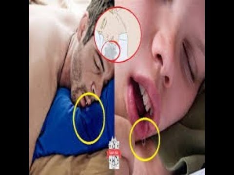 لايف ستايلشاهد: مخاطر اللعاب الموجود على الوسادة عند الاستيقاظ من النوم80474/0